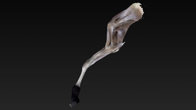 Membro Torácico Profundo